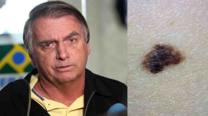 Bolsonaro solicita ao STF autorização para cirurgia em Brasília Ex-presidente Jair Bolsonaro em foto oficial, ilustrando pedido ao STF para sair da prisão domiciliar e realizar cirurgia em Brasília.